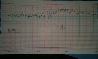 准妈妈必看孕期运动关注事项,孕期1-40周检查表明细表