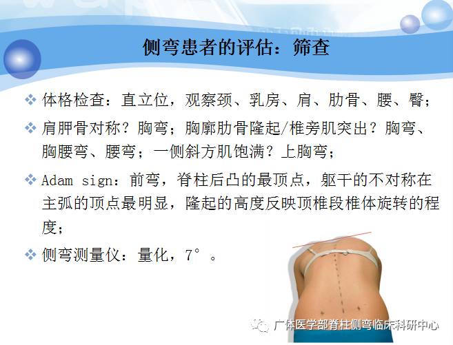 脊柱侧弯暑期训练营招募,脊柱侧弯夏令营视频