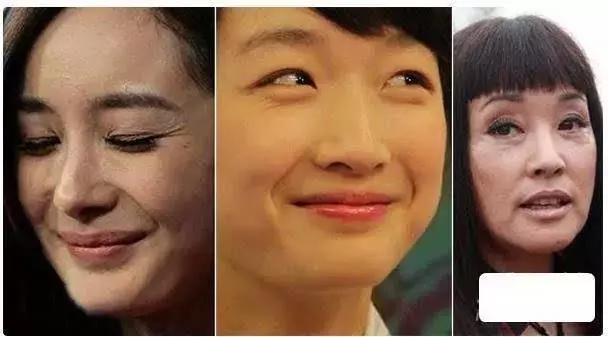 宋祖儿最好看的眼妆,宋祖儿怎么祛眼袋