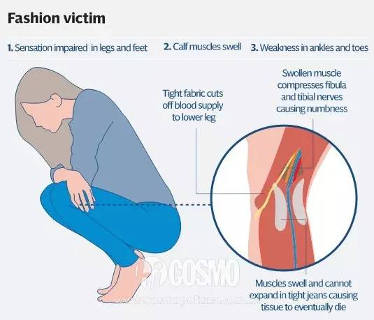 紧身牛仔裤都过时了你还穿