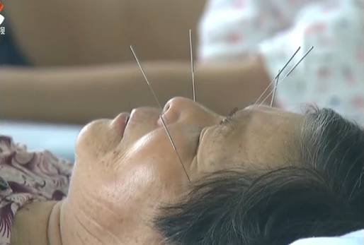 陈日新：持“灸”不息让中医再发力