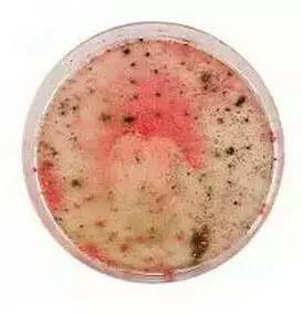 快翻翻你的包里有没有这些东西！放时间长了=毒药！