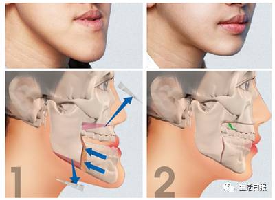少年黄飞鸿牙擦苏扮演者,少年黄飞鸿牙擦苏熬药那段