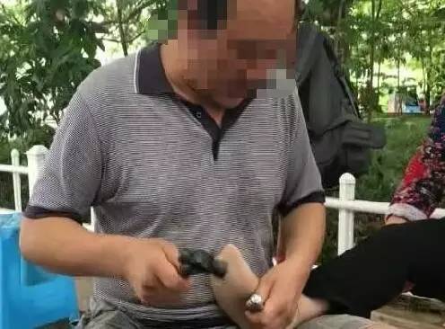 钉锤锤脚来治病！贵阳筑城广场这位“神医”手法太雷人！