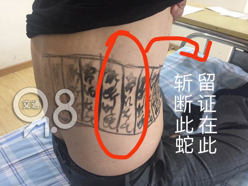 萧山大爷在自己腰上画符，用来治这种病！结果惨了……
