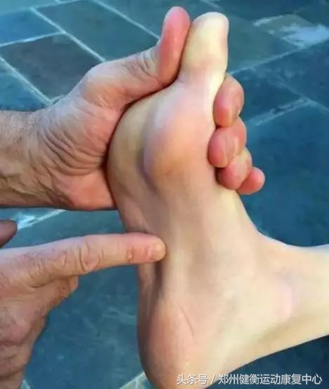 足底筋膜炎康复治疗,高足弓足底筋膜炎康复