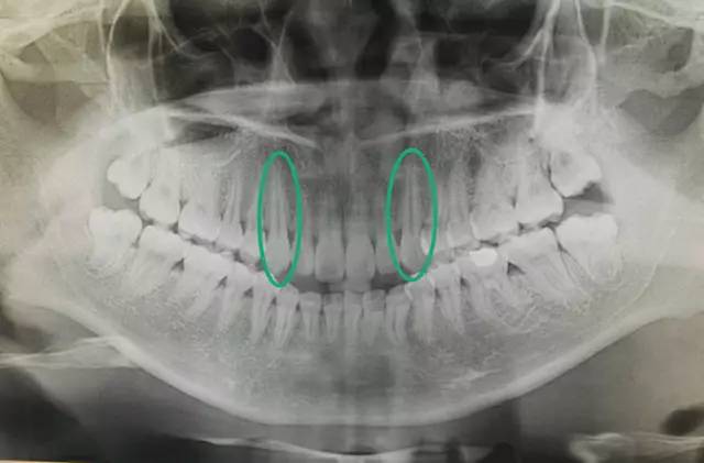你为*牙虎**纠结过吗？是可爱还是丑
