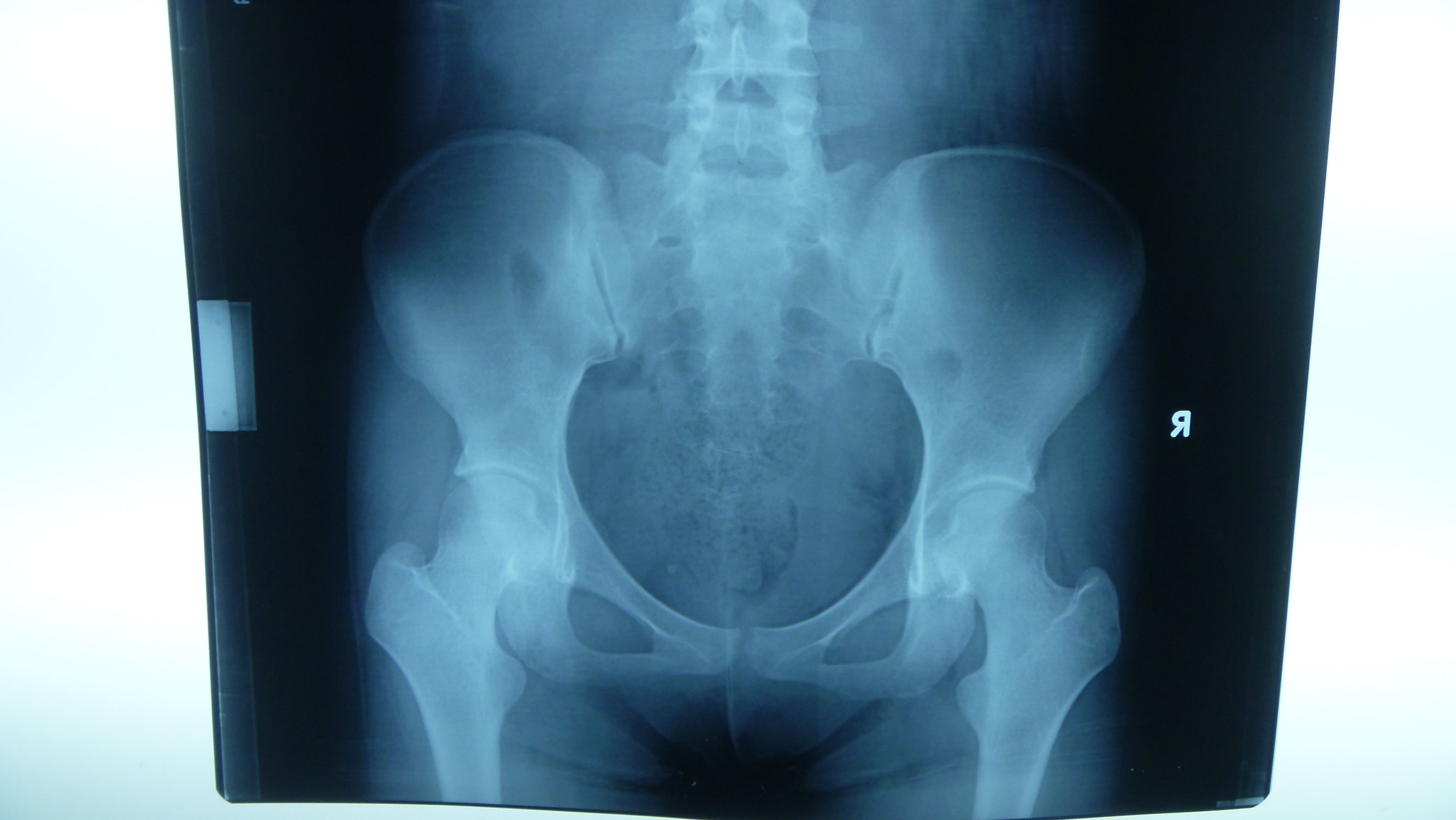 准妈妈必看孕期运动关注事项,孕期1-40周检查表明细表