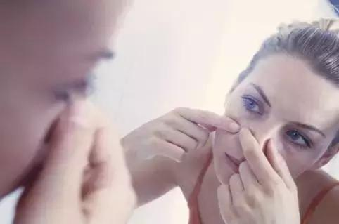 祛除黑头粉刺痘痘螨虫收缩毛孔,鼻子黑头多脸上毛孔大是螨虫