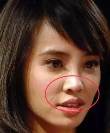 爱笑的人会有属于自己的法令纹,天生法令纹就很深怎么办又不爱笑