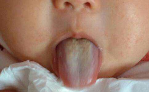 母乳宝宝体检不合格,母乳喂养的孩子健康吗