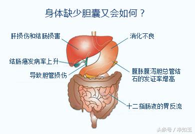 胆结石治疗方法和关注事项,胆结石正确治疗方法
