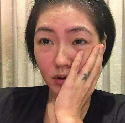 一着急脸红发烫什么原因,一热就脸红发烫头晕是怎么回事