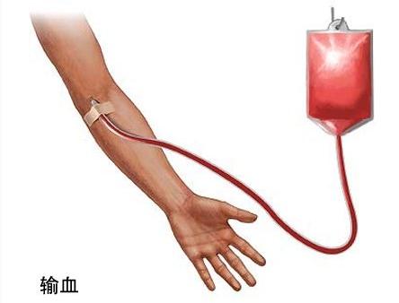 输血再障能治愈吗,输血能彻底治好吗