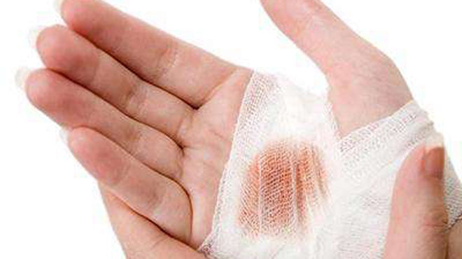 身上长红痣是肝出问题了吗,身上长红痣该查肝炎吗