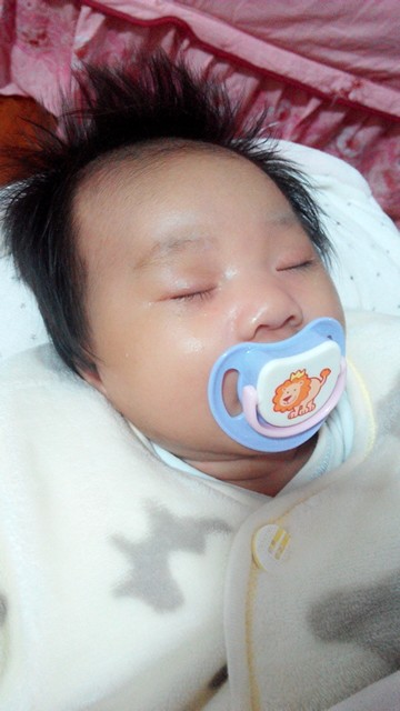 宝宝黄疸12.2需要停母乳吗,宝宝黄疸11.9医生打了预防针