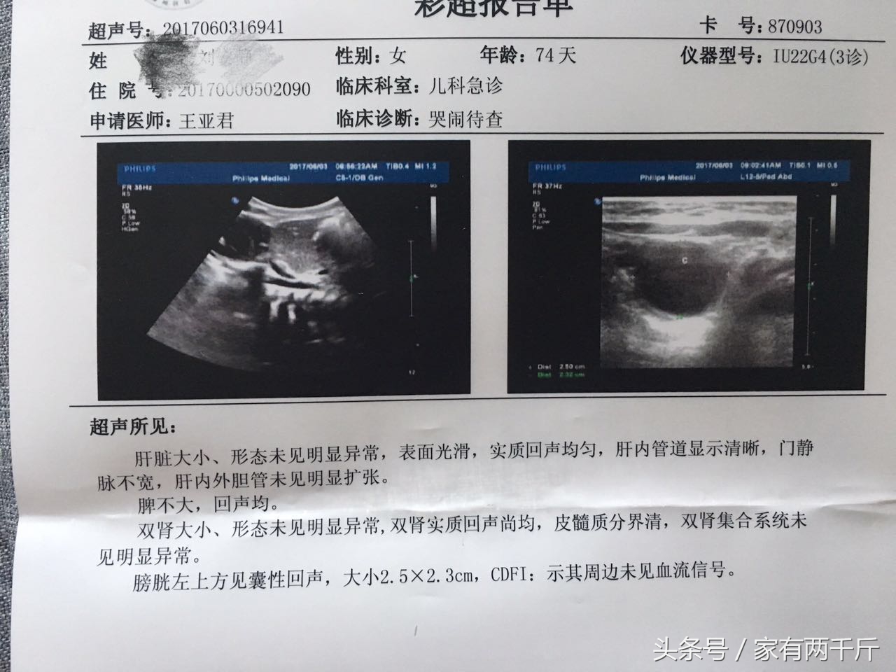 宝宝莫名哭闹小心是肠绞痛,宝宝异常哭闹睡不踏实