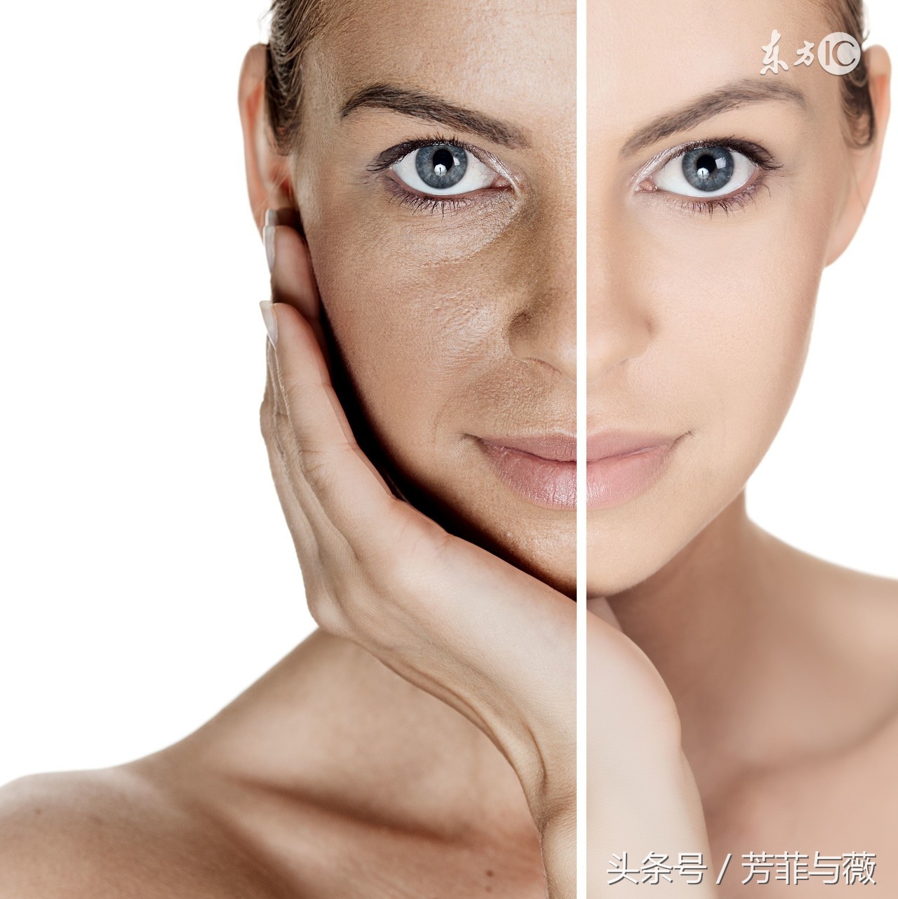 黑头到底怎么去啊,哪种黑头是去不掉的