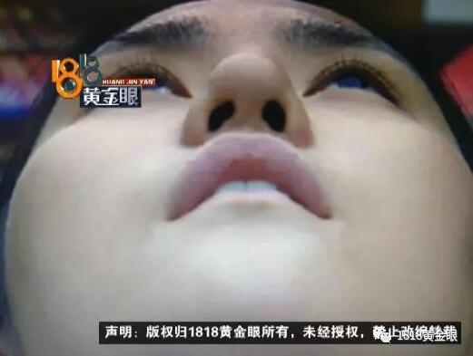 做鼻子整形手术后遗症,做鼻子手术女孩