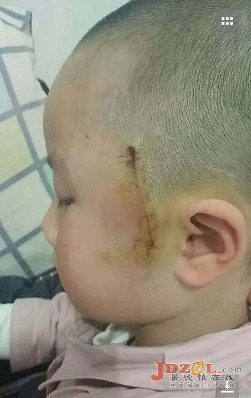 浮梁县臧湾乡村医徐文辉“见义勇为”纪实