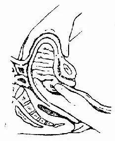 纱布门事件护理案例分析,纱布门事件原报道