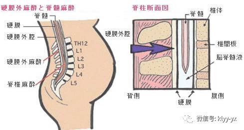 分娩｜剖宫产前后24小时，你经历了所有