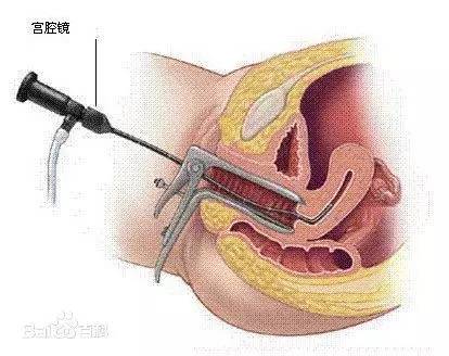纱布门事件护理案例分析,纱布门事件原报道
