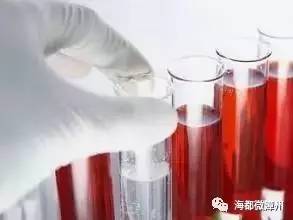 全身酸痛乏力流鼻涕高烧,大人身体消瘦流鼻血怎么回事