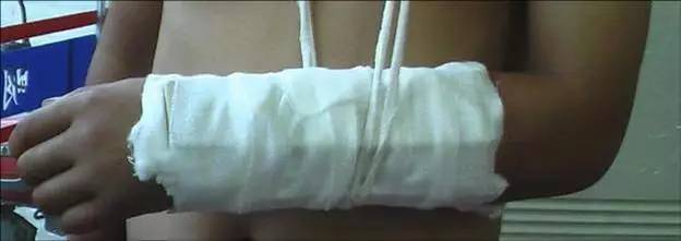 运动防护和急救小知识,运动伤害防护与急救知识点