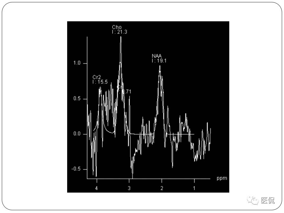 神经系统解剖ppt课件,神经内科课件ppt
