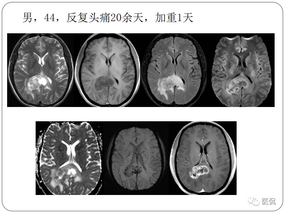 神经系统解剖ppt课件,神经内科课件ppt