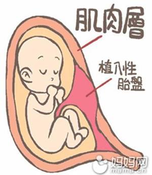 二胎如果怀在疤痕上有什么反应,二胎子宫疤痕薄能生三胎吗