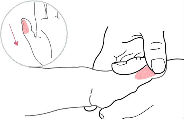 儿童扁桃体腺样体切除会发烧几天,扁桃体切除后孩子发烧怎么办