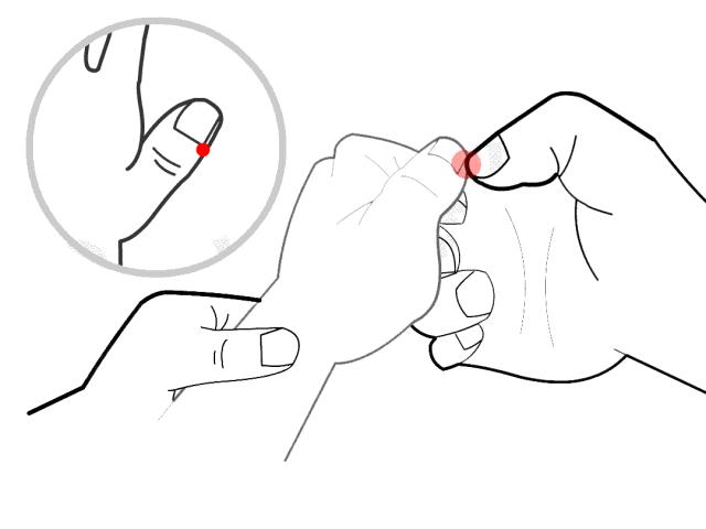 儿童扁桃体腺样体切除会发烧几天,扁桃体切除后孩子发烧怎么办