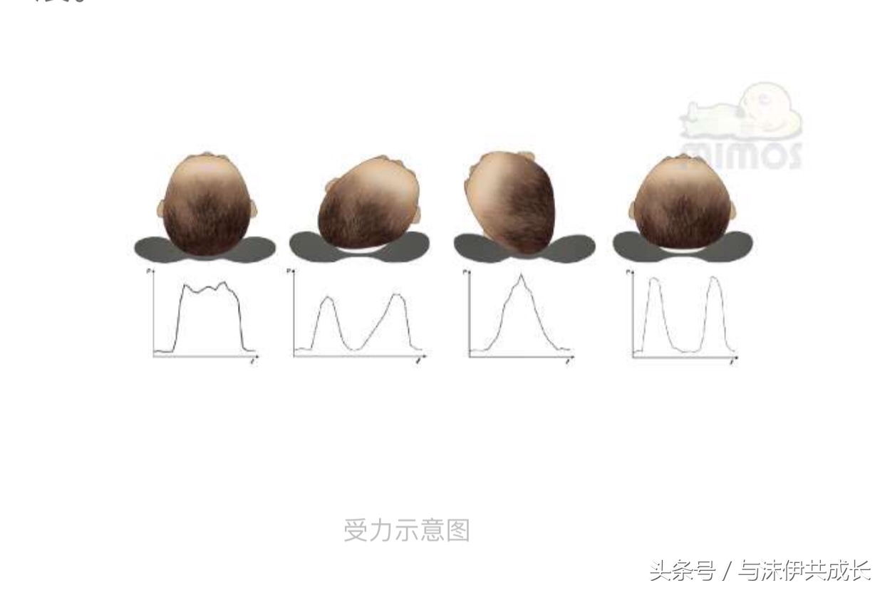 六个月的小孩歪头如何纠正,宝宝歪头右侧矫正方法