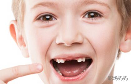 4岁换牙会不会太早,为什么有些孩子换牙早有些换牙晚