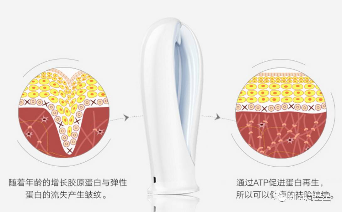 iluminagelaser美容仪,紧致去皱美白美容仪