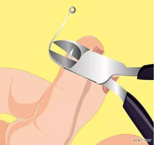 鱼钩钩到手指怎么办,鱼钩钩住手会得破伤风吗