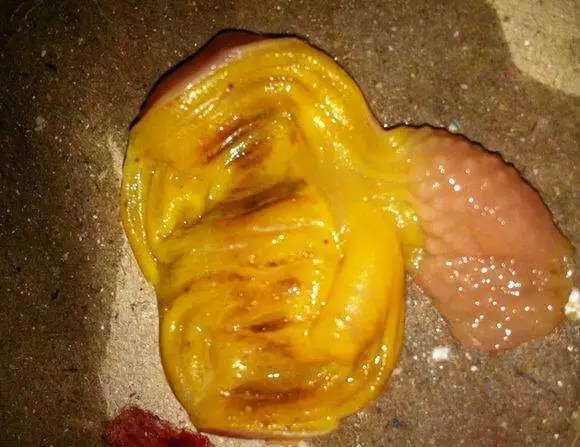 腺肌胃炎最简单方法,如何治疗腺肌胃炎