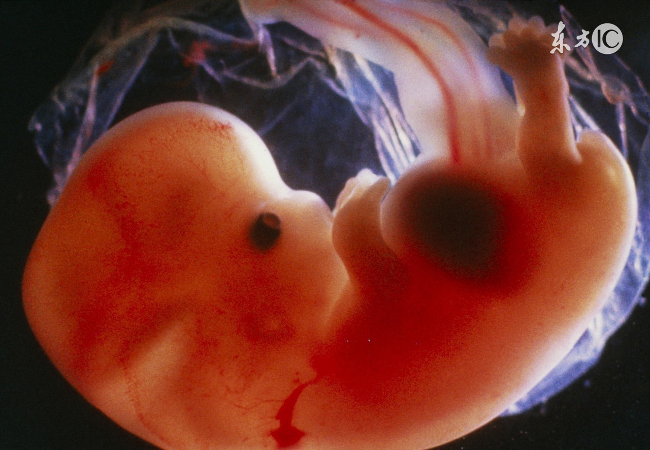 想要生二胎怎么办,结婚没生过小孩输卵管会堵吗