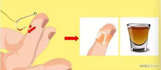 鱼钩钩到手指怎么办,鱼钩钩住手会得破伤风吗