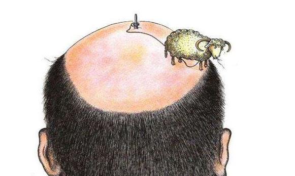 男性秃顶脱发去医院能治疗吗,男性秃顶脱发治疗最快的方法