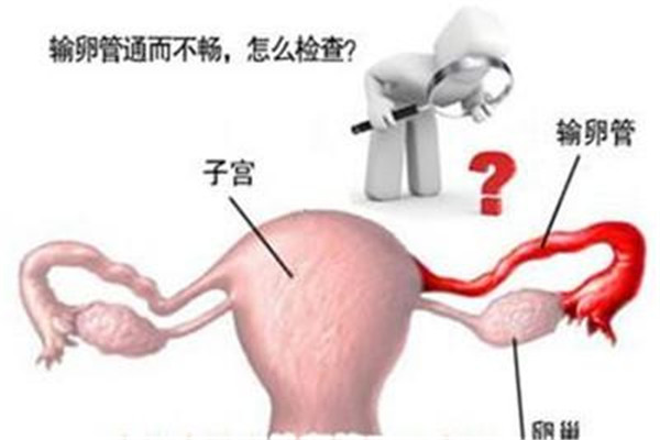 想要生二胎怎么办,结婚没生过小孩输卵管会堵吗