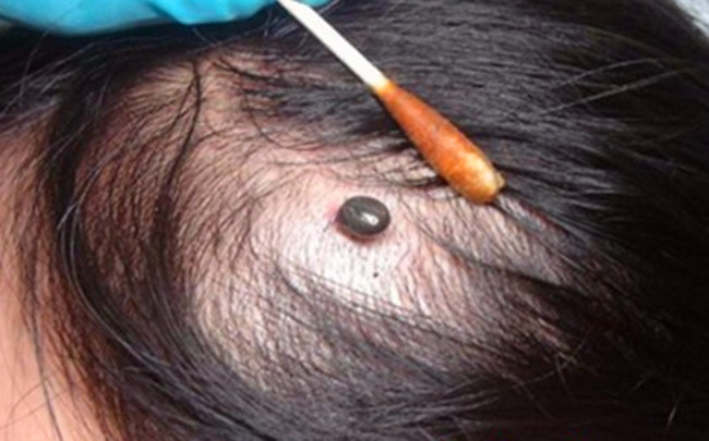 蚊子最怕的三种虫子,蚊子最怕的虫子排名