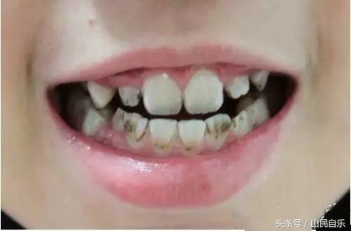 宝宝乳牙没长好怎么办,乳牙不好对宝宝的发育影响巨大