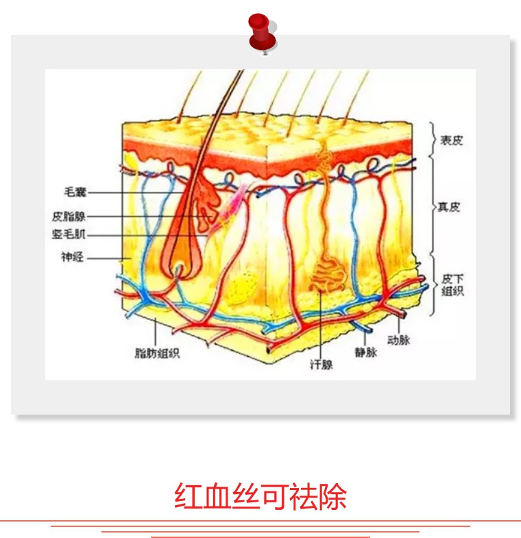 大腿上有血丝怎么祛除,血丝色斑