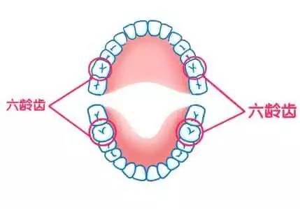 替牙期牙齿需要矫正吗,替牙期牙齿