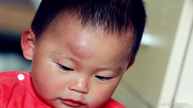 宝宝脑袋磕破了怎么办,宝宝脑袋磕了一个小包怎么办