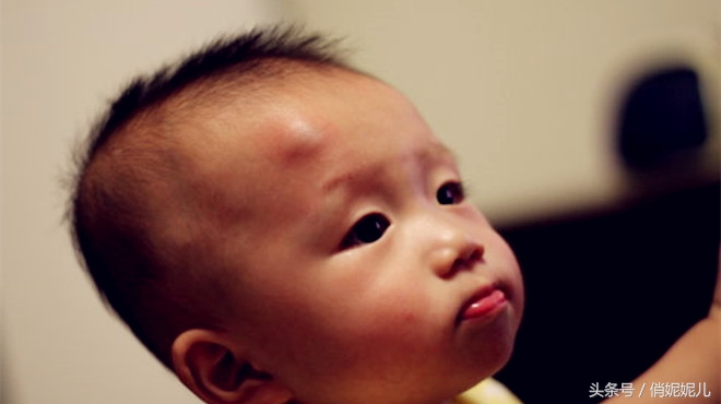 宝宝脑袋磕破了怎么办,宝宝脑袋磕了一个小包怎么办