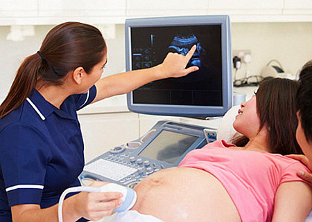 小玲每隔半年定期妇检，很少让爱人为自己担心，大家可以看看她的常规妇检项目